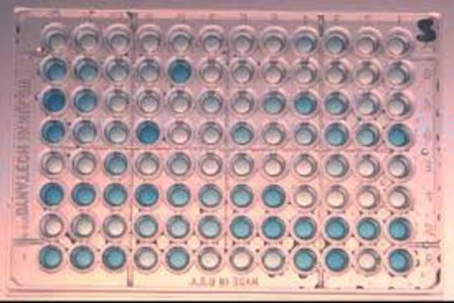 Development of ELISA test to screen for diseases such as HIV