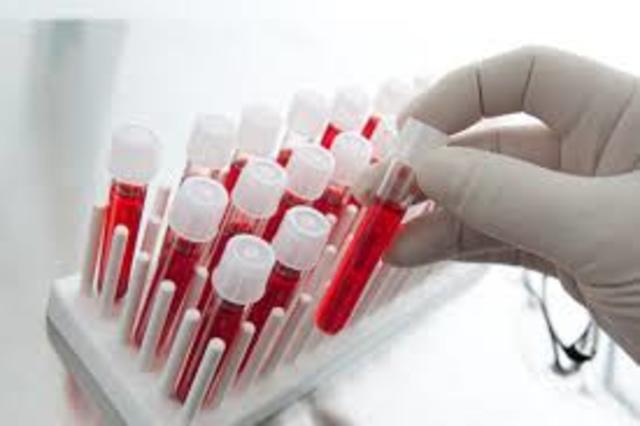 Scientists began developing blood-screening tests for infectious disease