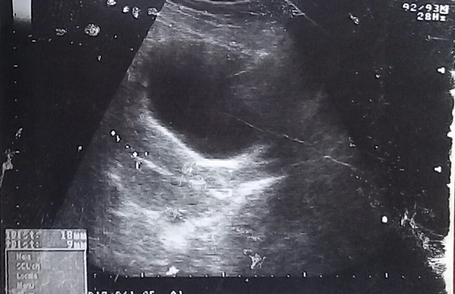 Etapa Intrauterina (parasitismo) -9 a -2