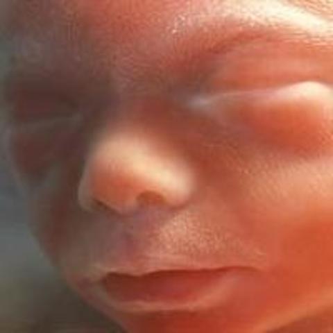 Semana Treinta y Cinco