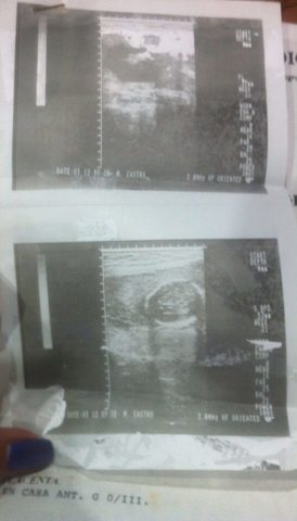 Etapa prenatal (9 meses de gestacion)