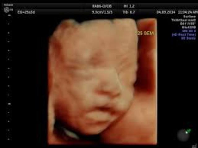 semana 26 de embarazo