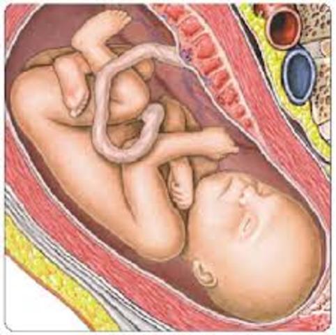 semana 31 de embarazo