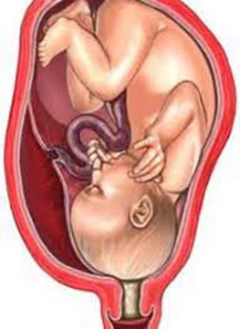 semana 40 de embarazo