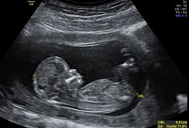 Semana 11 a 14 (Témino del primer trimestre en la semana 13)