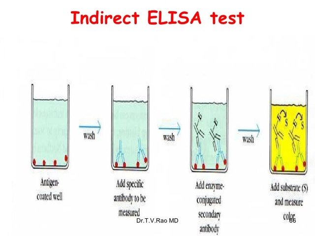 ELISA Test