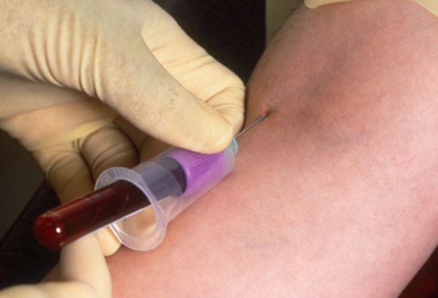 Blood-screening Tests