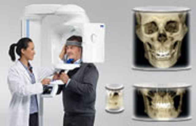 Tomógrafo de Haz Cónico