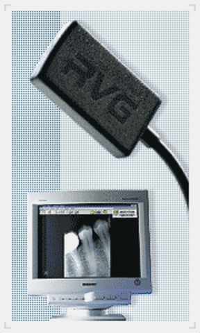 RadioVisografía de Trophy Radiology