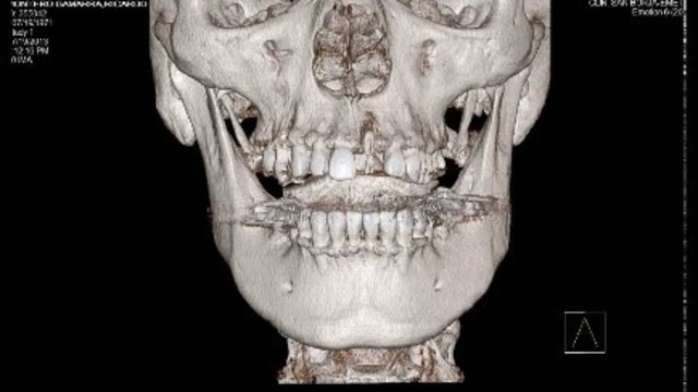 Mayor esplendor para la Odontología Computarizada