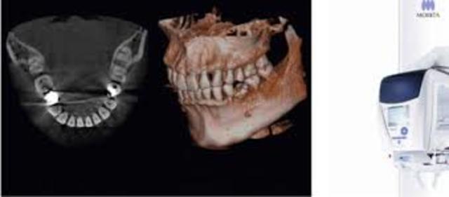 Radiología Digital Tridimensional