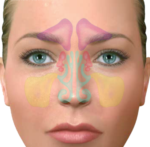 "Cancer de senos paranasales"