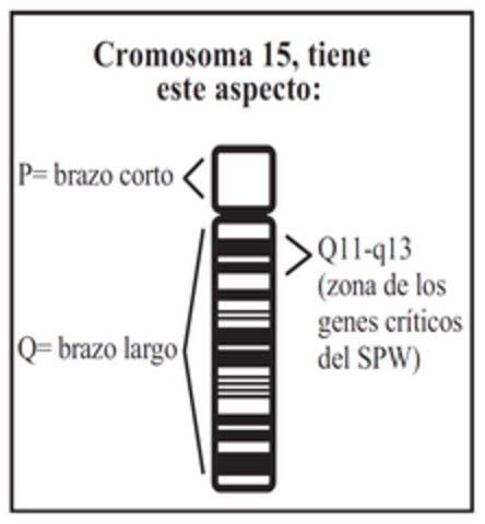 Síndrome de Prader-Willi