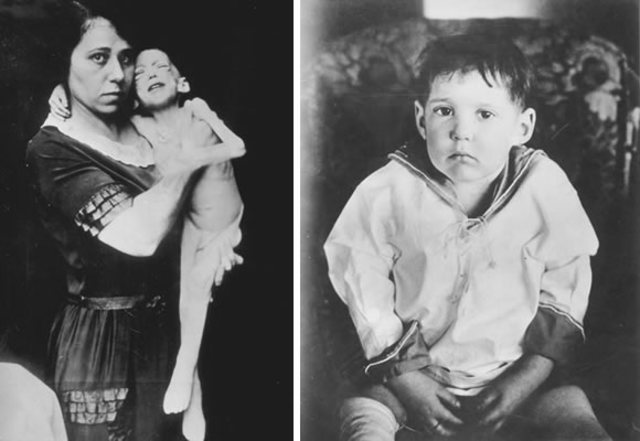 First Use of Insulin on a Human