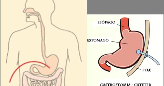 Evolución de la paciente