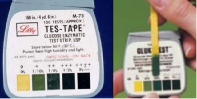 Tablets for Testing Urine Glucose Became Available