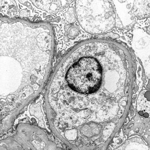 Un gran Invent: El microscopi electrònic