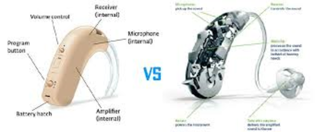 Digital Hearing Aids