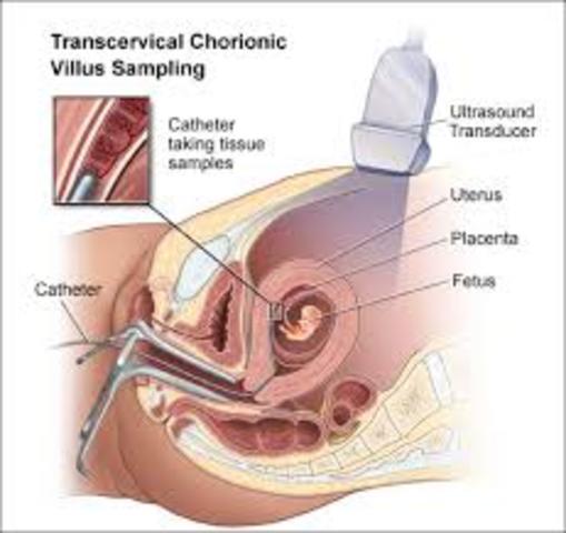 chorionic villi sampling could be performed