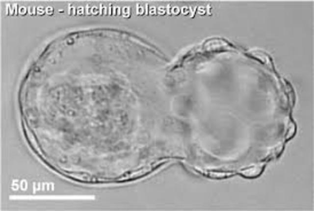 Hatching Blastocyst
