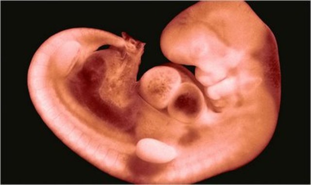 Heart Begins to Beat, Arm & Leg Buds Appear, Yolk Sac makes RBCs