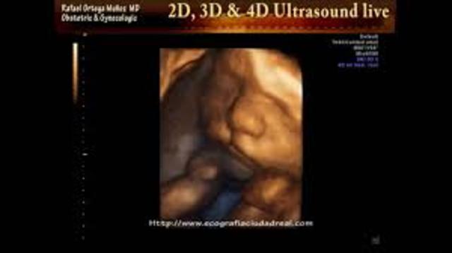 Cleft Lip or Palate May Occur