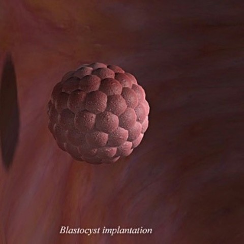 64 cell embryo called a blastocyst