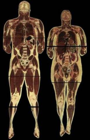 Visible Human Project®