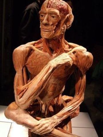 Plastinação