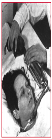 VENTILACION MANUAL DE PACIENTES