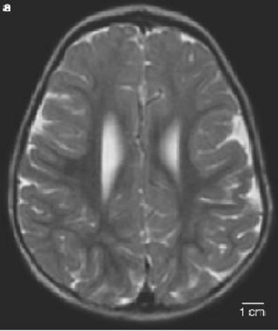 BY 8 Months Intellectually