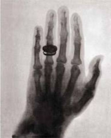 A primeira radiografia