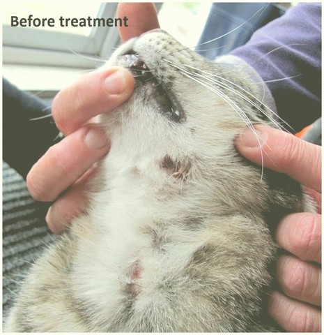 Absceso primeras apariciones