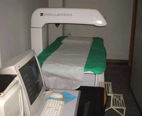 Equipamento de densitometria ossea.