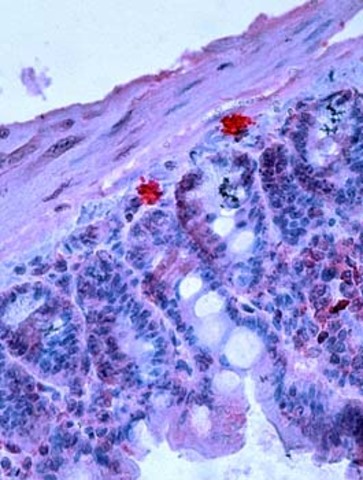 Modelo de ratón para estudios de mastocitos ideado.