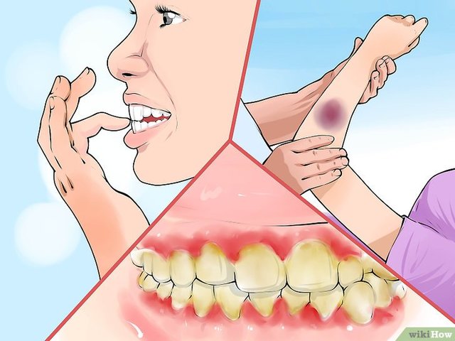 Cura contra el escorbuto
