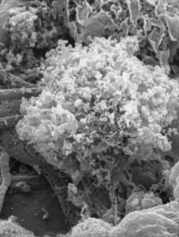 Trampas de neutrófilos.