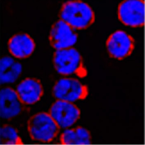 Asma y eosinófilos.