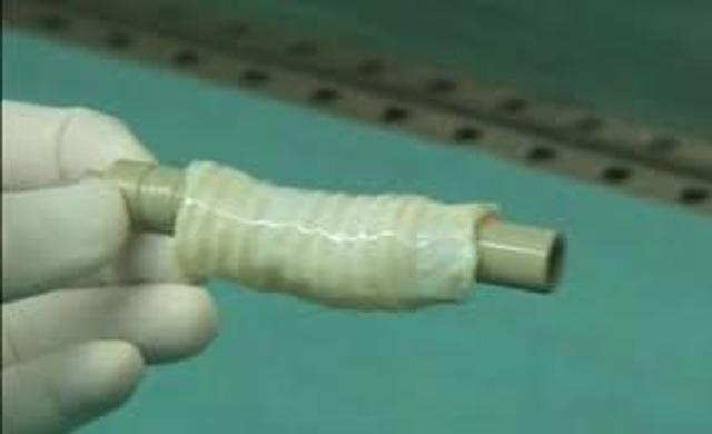 Primer trasplante de un órgano completo cultivado