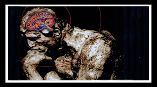 Corrientes Somaticistas (segunda mitad del siglo XIX)