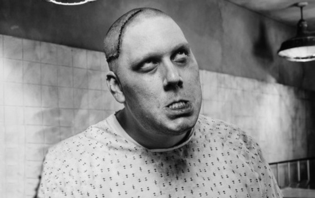 El Final de la Lobotomía