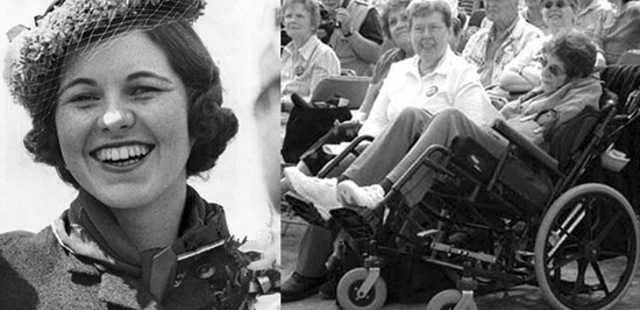 La Lobotomía de Rosemary Kennedy