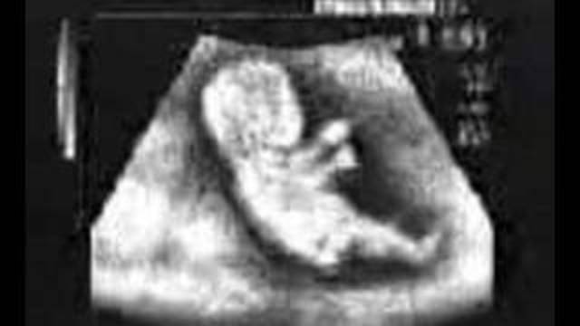 mi primera radiografía