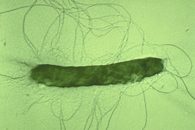 Enfermedad de la niebla del peral y del manzano