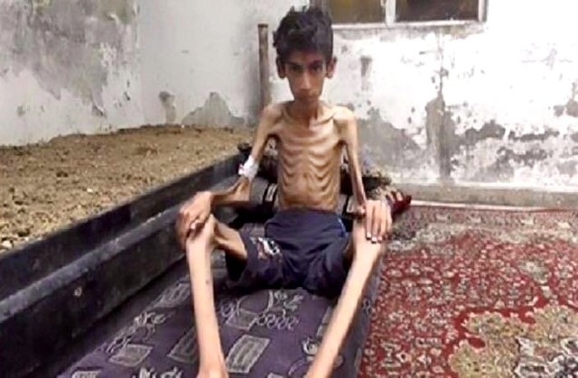 Crisis en Siria: la falta de alimentos amenaza a 20.000 niños en Madaya