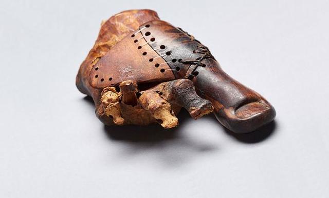 Earliest Example of a Prosthesis