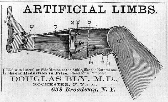 Doctor Bly’s Anatomical Leg