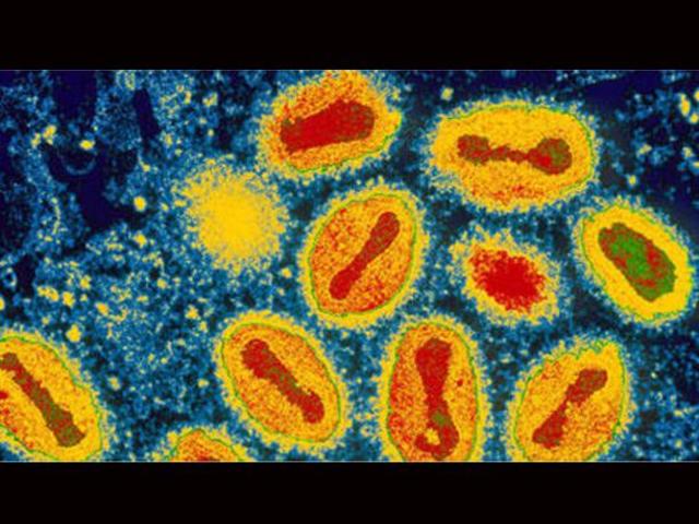 La OMS declara oficialmente erradicada a la viruela, la primera enfermedad humana en ser completamente vencida.