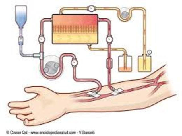 Primer uso de la diálisis