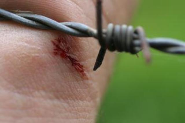 Vacuna contra el tetanos